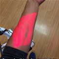 Accu Vein